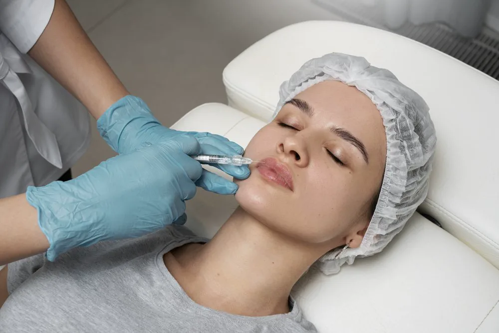 Volumen y Perfilado de Labios con Ácido Hialurónico